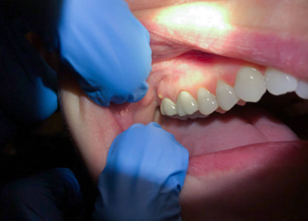 Best Weekend Emergency Dentist in Vicksburg, MS