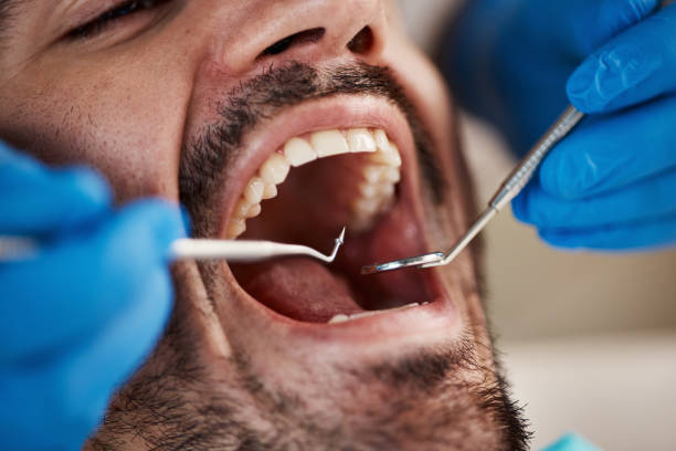 Best Weekend Emergency Dentist in Vicksburg, MS