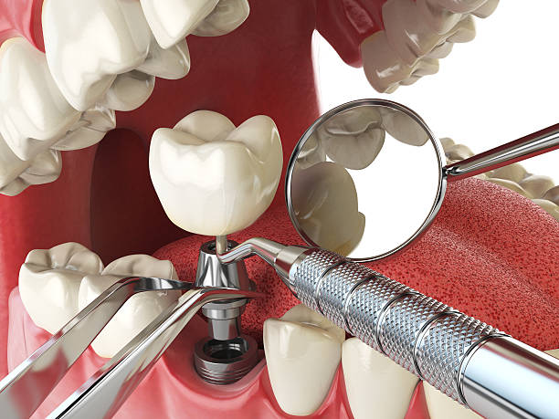 Best 24-Hour Emergency Dentist in Vicksburg, MS